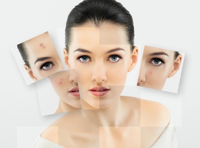 thắc mắc về mụn trứng cá thắc mắc về mụn trứng cá