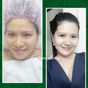 Làm Trắng Da Sau Sinh Với Nghệ và Trứng [Kinh Nghiệm] 