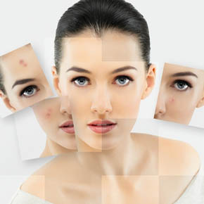 11 Câu Hỏi Thường Gặp Về Mụn Trứng Cá